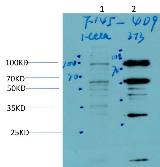 HIF-1Beta ARNT Monoclonal Antibody (4D9)