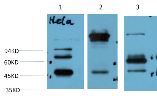 Phospho-GSK3Beta (Ser9) Monoclonal Antibody (6H9)
