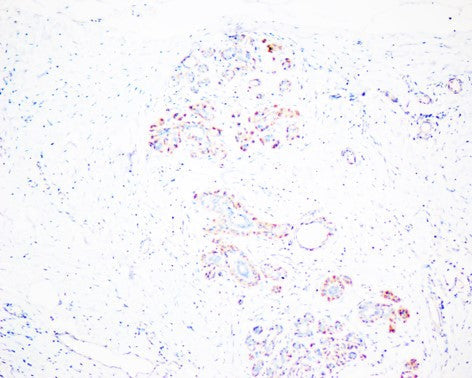 P70 S6 Kinase Monoclonal Antibody (8H8)