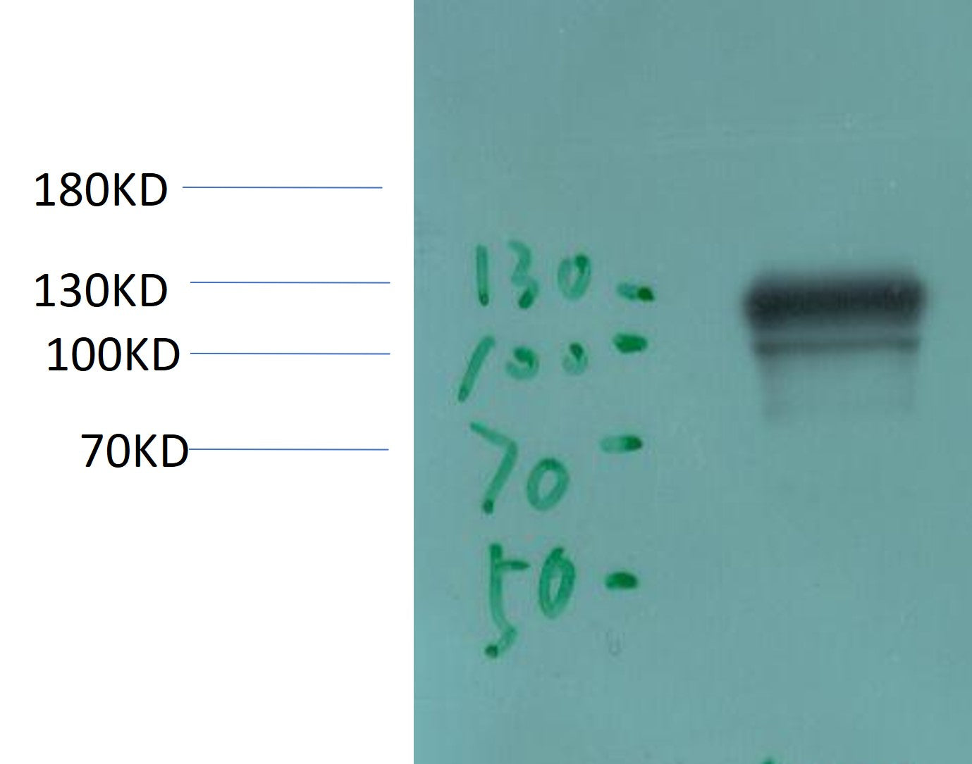 ACE2 Monoclonal Antibody (2C1)