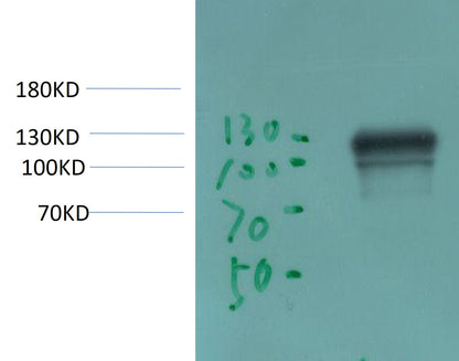 ACE2 Monoclonal Antibody (2C1)