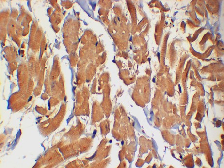 P38 Monoclonal Antibody (2F12)