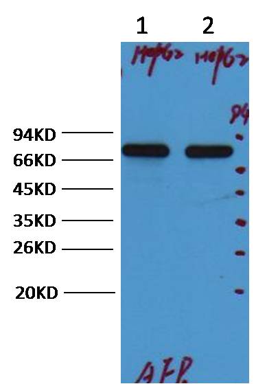 AFP alpha 1 Fetoprotein Monoclonal Antibody (17C5)