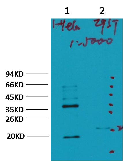 CA IX Carbonic Anhydrase IX Monoclonal Antibody (12F10)