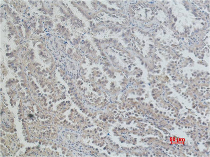 ERCC1 Monoclonal Antibody (4F12)