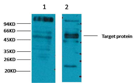 CD23 Monoclonal Antibody (10H2)