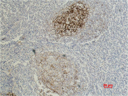 CD23 Monoclonal Antibody (10H2)