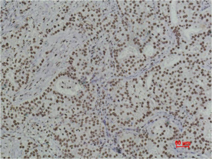 Histone H3 (di methyl K79) Monoclonal Antibody (Q7)