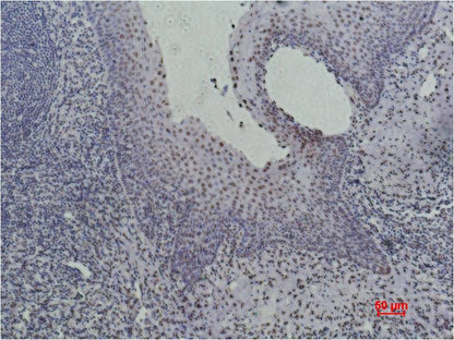 Histone H3 (tri methyl K36) Monoclonal Antibody (Q12)