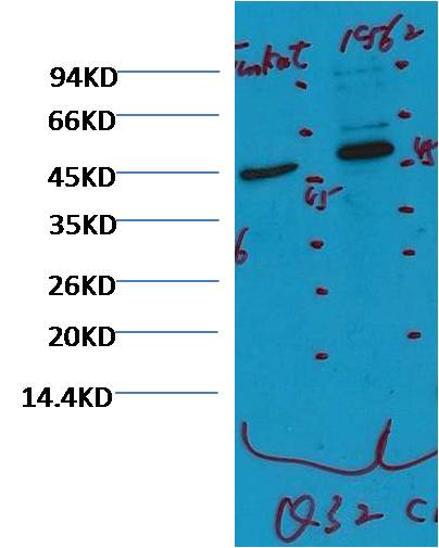 CD16 Monoclonal Antibody (Q32)
