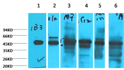 Cytokeratin 18 Monoclonal Antibody (1B3)