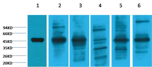 Cytokeratin 18 Monoclonal Antibody (8F2)