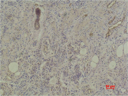 Histone H3 (di methyl K27) Monoclonal Antibody (1A8)