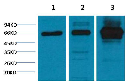 NFκB p65 Monoclonal Antibody (5G6)