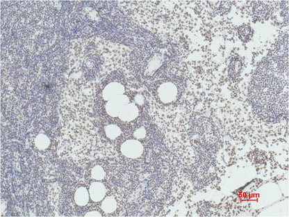 Histone H3 (di methyl K36) Monoclonal Antibody (1E6)