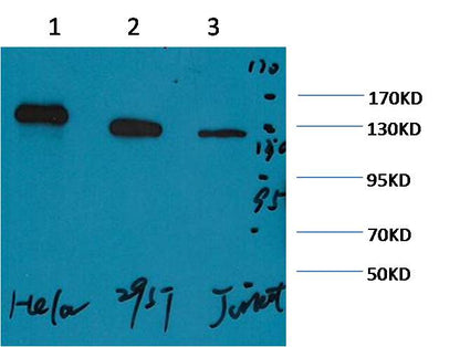 PARP Monoclonal Antibody (M3)