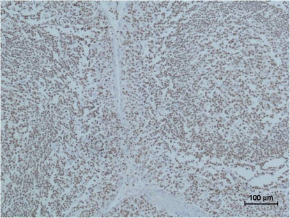 PARP Monoclonal Antibody (M3)