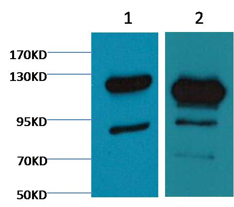 Cleaved PARP Monoclonal Antibody (M4)