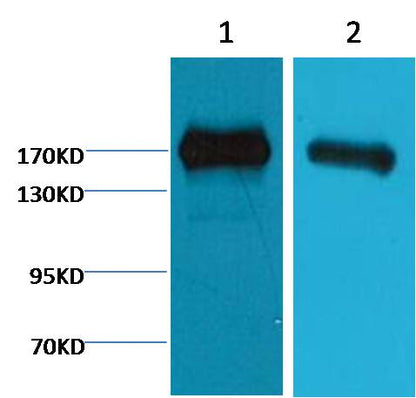 EGFR Monoclonal Antibody (M6)