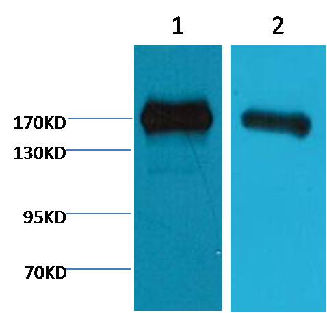 EGFR Monoclonal Antibody (M6)
