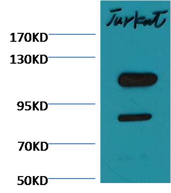 Cleaved PARP Monoclonal Antibody (Mix-mA™)
