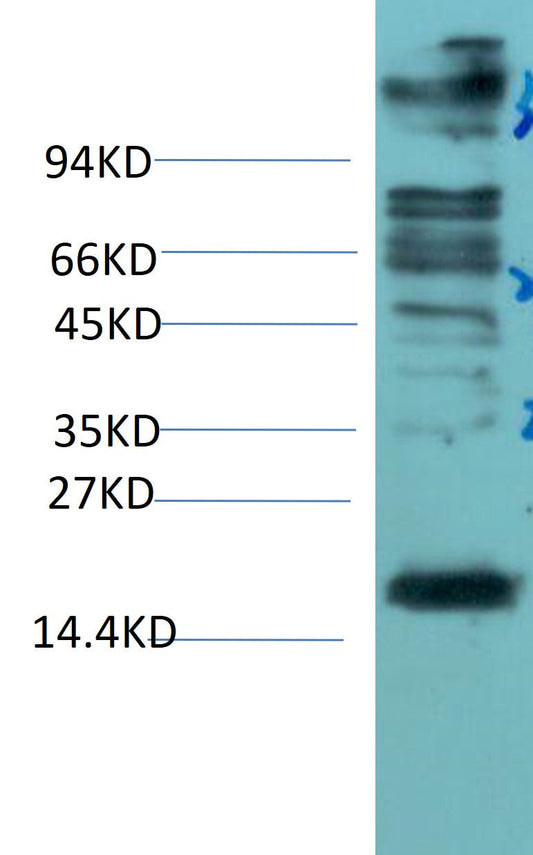 P21 Mouse Monoclonal Antibody (Mix-mA)