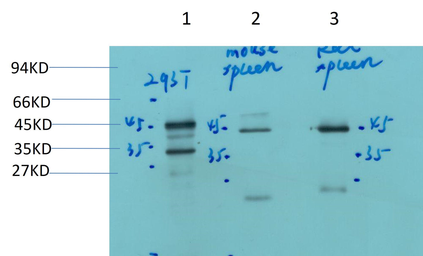 PAX-5 Mouse Monoclonal Antibody (Mix-mA)