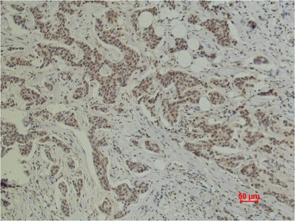 Histone H1 Polyclonal Antibody
