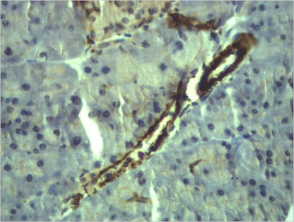 Alpha-Smooth Muscle Actin Polyclonal Antibody