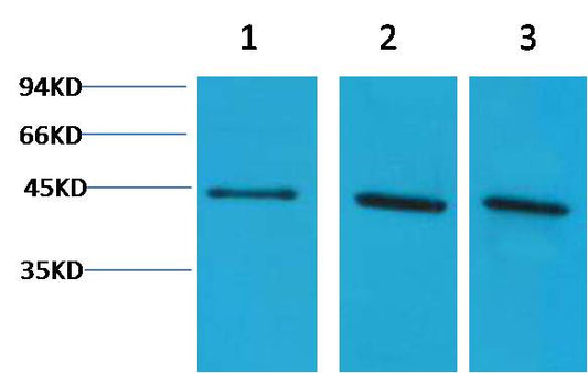 Alpha-Skeletal Muscle Actin Polyclonal Antibody