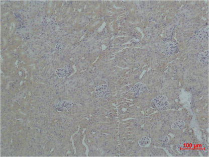 ZNF499 Polyclonal Antibody