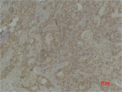 Histone H4 (Tri Methyl Lys20) Polyclonal Antibody