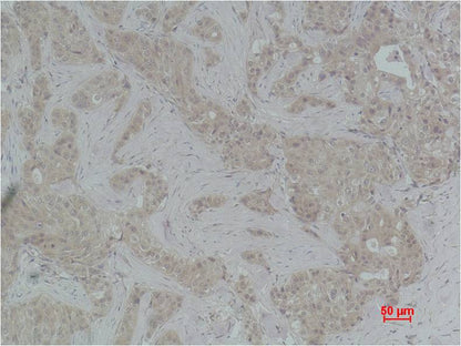 Histone H4 (Di Methyl Lys79) Polyclonal Antibody