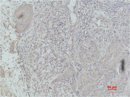 Histone H2B (Mono Methyl Lys5) Polyclonal Antibody