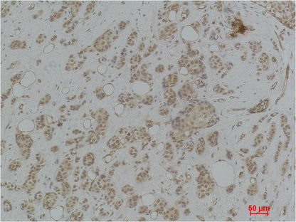 Histone H2B (Tri Methyl Lys43) Polyclonal Antibody