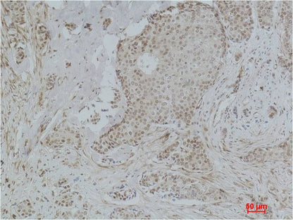 Histone H3 (Acetyl Lys36) Polyclonal Antibody