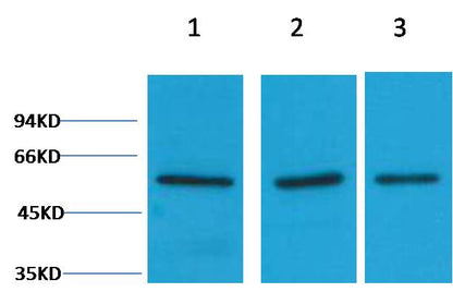 Vimentin Polyclonal Antibody