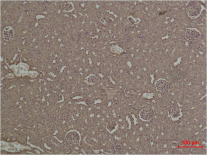 HIF-1Alpha Polyclonal Antibody