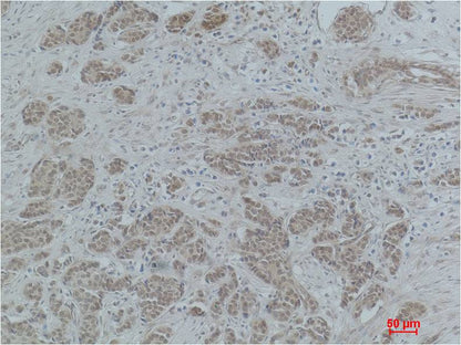 Histone H4 (Acetyl Lys5) Polyclonal Antibody