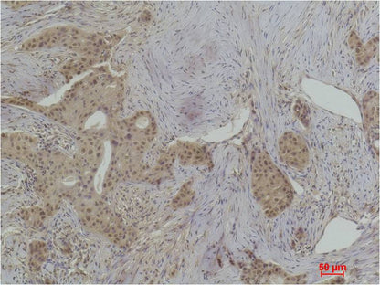 Histone H1 (Phospho Thr17) Polyclonal Antibody