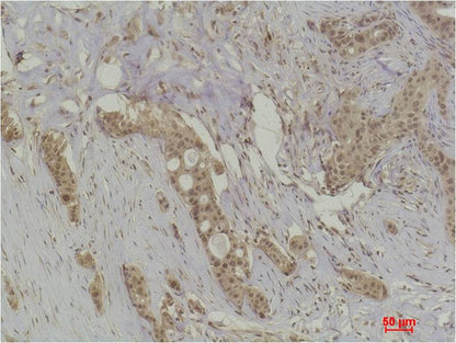 Histone H4 (Acetyl Lys91) Polyclonal Antibody