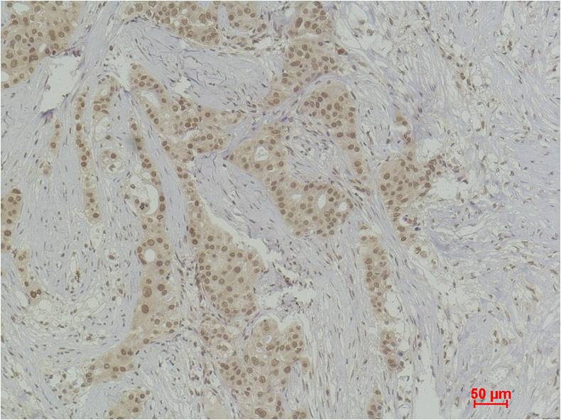 Histone H4 (Mono Methyl Arg3) Polyclonal Antibody