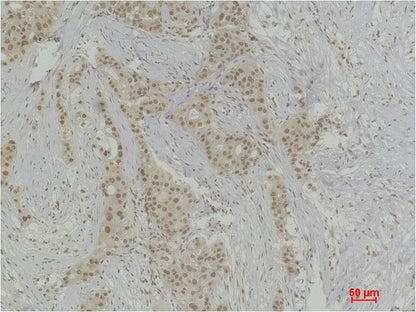 Histone H4 (Mono Methyl Arg3) Polyclonal Antibody