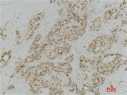 Histone H3 (Di Methyl Lys9) Polyclonal Antibody