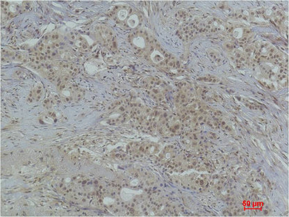 Histone H3 (Tri Methyl Lys79) Polyclonal Antibody