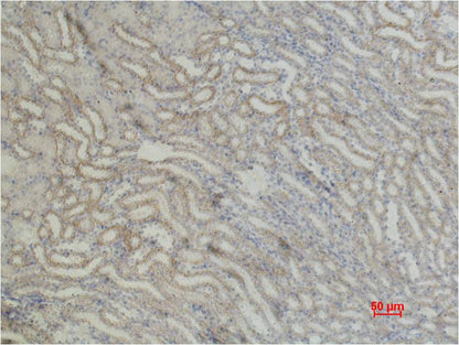 beta 1 Sodium Potassium ATPase Polyclonal Antibody