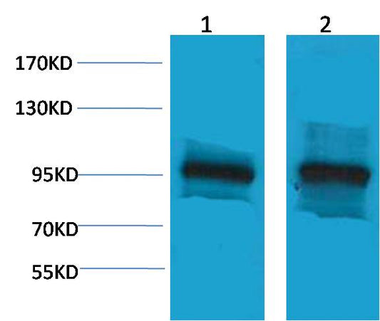 Beta-Catenin Polyclonal Antibody
