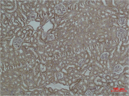 HSP60 Polyclonal Antibody (F161)