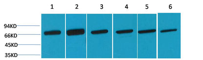 HSC70 Polyclonal Antibody (F154)