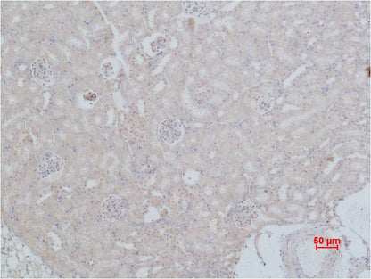 HSC70 Polyclonal Antibody (F154)